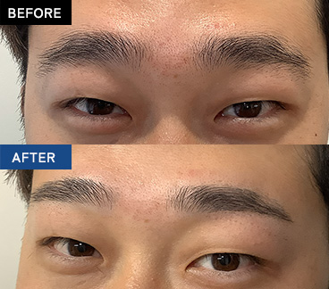 BEFORE AFTER 画像