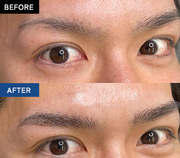 BEFORE AFTER 画像